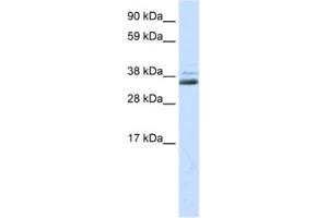Western Blotting (WB) image for anti-Secreted Frizzled-Related Protein 1 (SFRP1) antibody (ABIN2463723) (SFRP1 antibody)