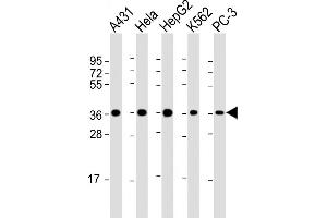 All lanes : Anti-EX1 Antibody at 1:2000 dilution Lane 1: A431 whole cell lysate Lane 2: Hela whole cell lysate Lane 3: HepG2 whole cell lysate Lane 4: K562 whole cell lysate Lane 5: PC-3 whole cell lysate Lysates/proteins at 20 μg per lane. (APEX1 antibody)