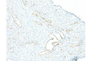 Immunohistochemistry (IHC) image for anti-Cadherin 5 (CDH5) (AA 25-595) antibody (ABIN7453992) (Recombinant Cadherin 5 antibody  (AA 25-595))