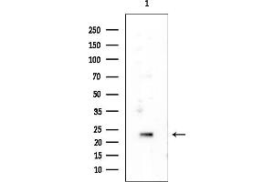 anti-Transmembrane BAX Inhibitor Motif Containing 6 (TMBIM6) antibody