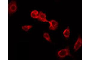 ABIN6274914 staining HeLa by IF/ICC. (Glucuronidase beta antibody  (Internal Region))