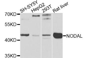 Western blot analysis of extracts of various cell lines, using NODAL antibody. (Nodal antibody)