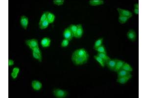 Immunofluorescence staining of HepG2 cells with ABIN7160260 at 1:100, counter-stained with DAPI. (ZFP36 antibody  (AA 16-103))