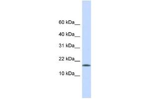 WB Suggested Anti-CENPA Antibody Titration:  0. (CENPA antibody  (Middle Region))
