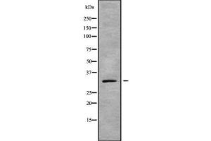 GJB5 antibody  (C-Term)