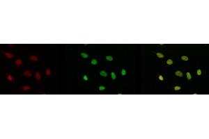 Immunofluorescence (IF) image for anti-Tumor Protein P53 (TP53) (acLys315) antibody (ABIN3201007) (p53 antibody  (acLys315))