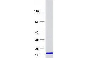 Validation with Western Blot (UBE2D4 Protein (Myc-DYKDDDDK Tag))