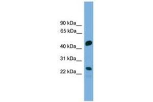 Image no. 1 for anti-Cell Division Cycle Associated 4 (CDCA4) (AA 143-192) antibody (ABIN6745604) (CDCA4 antibody  (AA 143-192))