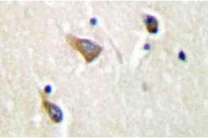 Immunohistochemistry (IHC) analyzes of Clusterin-alpha antibody in paraffin-embedded human brain tissue. (Clusterin antibody)