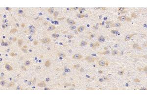 Detection of LCAT in Mouse Cerebrum Tissue using Polyclonal Antibody to Lecithin Cholesterol Acyltransferase (LCAT) (LCAT antibody  (AA 41-210))