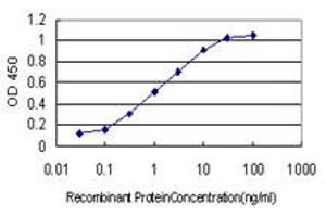 Detection limit for recombinant GST tagged LAMB3 is approximately 0. (Laminin beta 3 antibody  (AA 1064-1171))