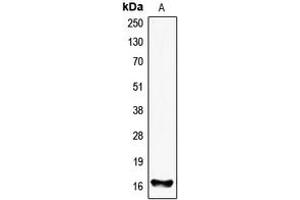 Western blot analysis of FHIT expression in HEK293T (A) whole cell lysates. (FHIT antibody  (Center))