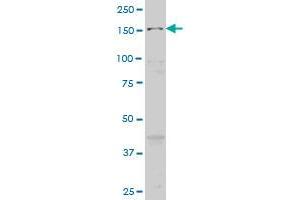 MAP3K5 monoclonal antibody (M02), clone 1E3 Western Blot analysis of MAP3K5 expression in HepG2 . (ASK1 antibody  (AA 1231-1374))