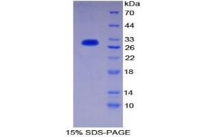 SDS-PAGE analysis of Human PIK3C2a Protein. (Phosphoinositide-3-Kinase, Class 2, alpha Polypeptide (PIK3C2A) Peptide)