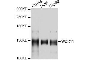 Western blot analysis of extracts of various cells, using WDR11 antibody. (WDR11 antibody)