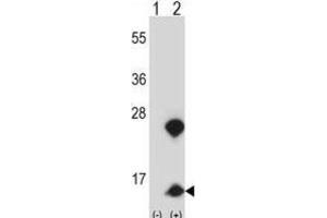 Western Blotting (WB) image for anti-High Mobility Group Nucleosome Binding Domain 1 (HMGN1) antibody (ABIN2997819)