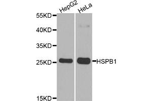 Western blot analysis of extracts of various cell lines, using HSPB1 antibody (ABIN5970070) at 1/1000 dilution. (HSP27 antibody)