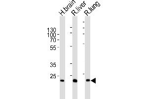 Western blot analysis of lysates from human brain , rat liver and lung tissue lysate (from left to right), using GSTT1 Antibody (N-term) (ABIN6244315 and ABIN6577396). (GSTT1 antibody  (N-Term))