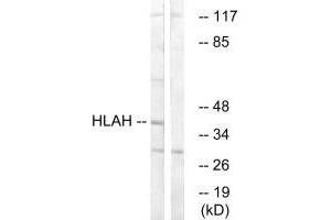 Western blot analysis of extracts from LOVO cells, using HLAH antibody. (HLA-H antibody)