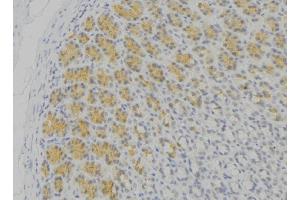 ABIN6276673 at 1/100 staining Human gastric tissue by IHC-P.