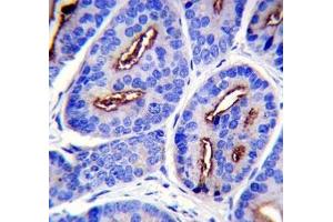 PSMA antibody immunohistochemistry analysis in formalin fixed and paraffin embedded human prostate carcinoma. (PSMA antibody  (AA 161-190))