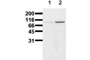 Western Blotting (WB) image for anti-Catenin (Cadherin-Associated Protein), beta 1, 88kDa (CTNNB1) (pTyr86) antibody (ABIN126740) (CTNNB1 antibody  (pTyr86))