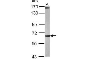 WB Image Sample (50 ug of whole cell lysate) A: mouse liver 7. (CROT antibody)