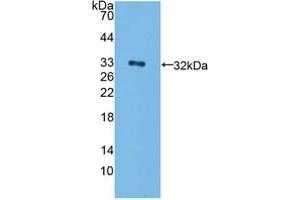 Detection of Recombinant ErbB4, Human using Polyclonal Antibody to Erb-b2 Receptor Tyrosine Kinase 4 (ErbB4) (ERBB4 antibody  (AA 29-278))