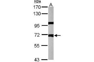 WB Image Sample (50 ug of whole cell lysate) A: mouse liver 7. (PPP1R16A antibody  (Center))