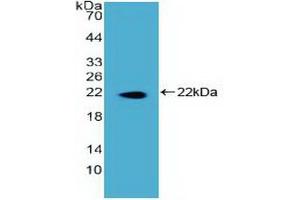 Detection of Recombinant DKC, Human using Polyclonal Antibody to Dyskerin (DKC) (DKC1 antibody)