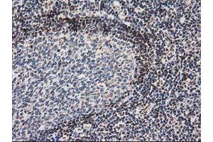 Image no. 3 for anti-Nonhomologous End-Joining Factor 1 (NHEJ1) antibody (ABIN1499729) (NHEJ1 antibody)