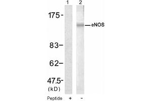 Image no. 1 for anti-Nitric Oxide Synthase 3 (Endothelial Cell) (NOS3) (Ser1177) antibody (ABIN319319) (ENOS antibody  (Ser1177))
