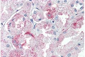 Kidney, Human: Formalin-Fixed, Paraffin-Embedded (FFPE) (GPR146 antibody  (Internal Region))