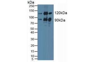 Western blot analysis of (1) Human HeLa cells, (2) Mouse Brain Tissue and (3) Porcine Brain Tissue. (PKC epsilon antibody  (AA 403-672))