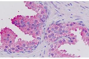 Human Prostate: Formalin-Fixed, Paraffin-Embedded (FFPE) (AF4 antibody  (AA 1181-1210))