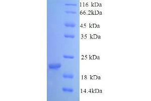Caveolin 1, Caveolae Protein, 22kDa (CAV1) (AA 1-178) protein (His tag)