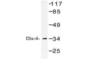 Western blot (WB) analysis of Dlx-4 antibody in extracts from COLO cells. (DLX4 antibody)