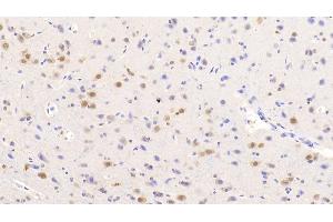 Detection of NOVA1 in Human Cerebrum Tissue using Polyclonal Antibody to Neuro Oncological Ventral Antigen 1 (NOVA1) (NOVA1 antibody  (AA 295-510))