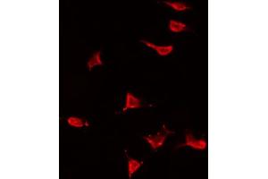 ABIN6266704 staining HeLa by IF/ICC. (MAP3K13 antibody  (N-Term))