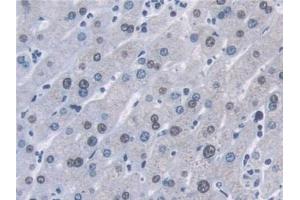 Detection of AHNAK in Human Liver Tissue using Polyclonal Antibody to Desmoyokin (AHNAK) (AHNAK antibody  (AA 1-300))