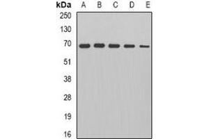 Western blot analysis of PDC-E2 expression in HepG2 (A), Jurkat (B), mouse heart (C), rat brain (D), rat kidney (E) whole cell lysates.