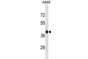 Western Blotting (WB) image for anti-G Protein-Coupled Receptor 77 (GPR77) antibody (ABIN3001276) (GPR77 antibody)