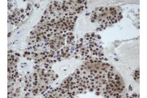 Image no. 2 for anti-Cullin 4B (CUL4B) (AA 1-300) antibody (ABIN1490724) (Cullin 4B antibody  (AA 1-300))