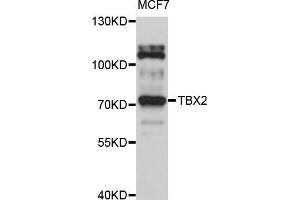 Western blot analysis of extracts of MCF-7 cells, using TBX2 antibody (ABIN5999016) at 1/1000 dilution. (TBX2 antibody)