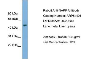 WB Suggested Anti-NARF  Antibody Titration: 0. (NARF antibody  (Middle Region))