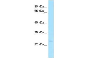 Host: Rabbit Target Name: NUDT14 Sample Type: Fetal Heart lysates Antibody Dilution: 1. (NUDT14 antibody  (Middle Region))