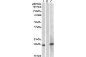 HEK293 lysate (10 µg protein in RIPA buffer) overexpressing Human HOXA1 with C-terminal MYC tag probed with AP21275PU-N (1 ug/ml) in Lane A and probed with anti-MYC Tag (1/1000) in lane C. (HOXA1 antibody)