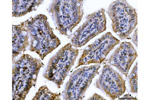 IHC analysis of Cdk2 using anti-Cdk2 antibody (ABIN7602523). (CDK2 antibody  (AA 81-298))