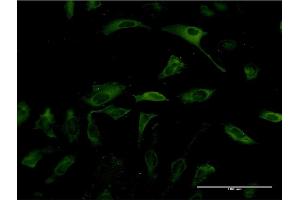 Immunofluorescence of monoclonal antibody to PKLR on HeLa cell. (PKLR antibody  (AA 485-574))