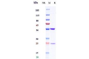 Anti-MAGE-A4 Reference Antibody (Imc-C103C) on SDS-PAGE under reducing (R) condition.